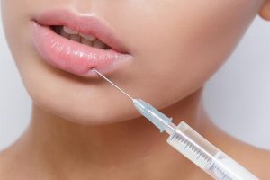 New to Dermal Fillers? Follow These Steps to Prevent Bruising Before Your First Treatment